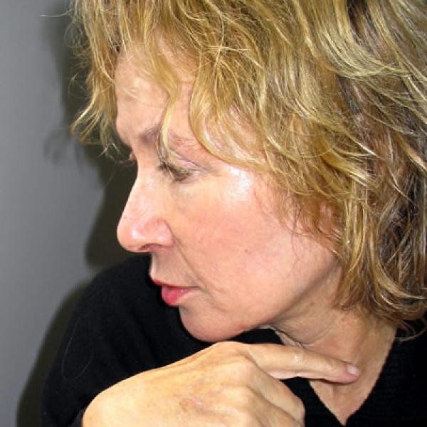 Tsipi  Keller