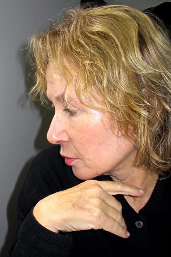 Tsipi Keller